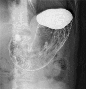P005
